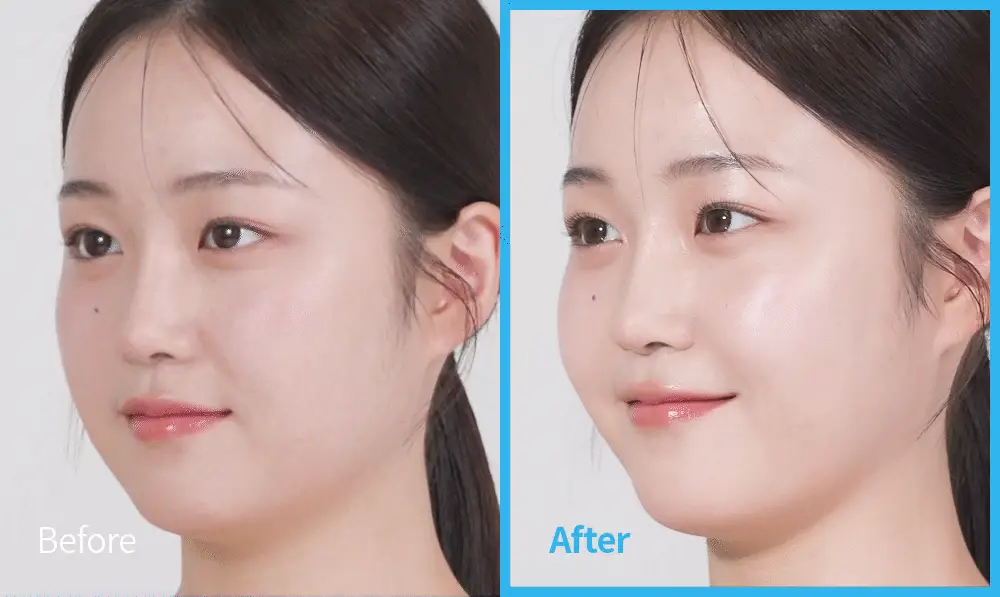 [수분 선크림] 벤튼 시카 수분 선쿠션 SPF50+/PA++++ 15g 상세페이지 28